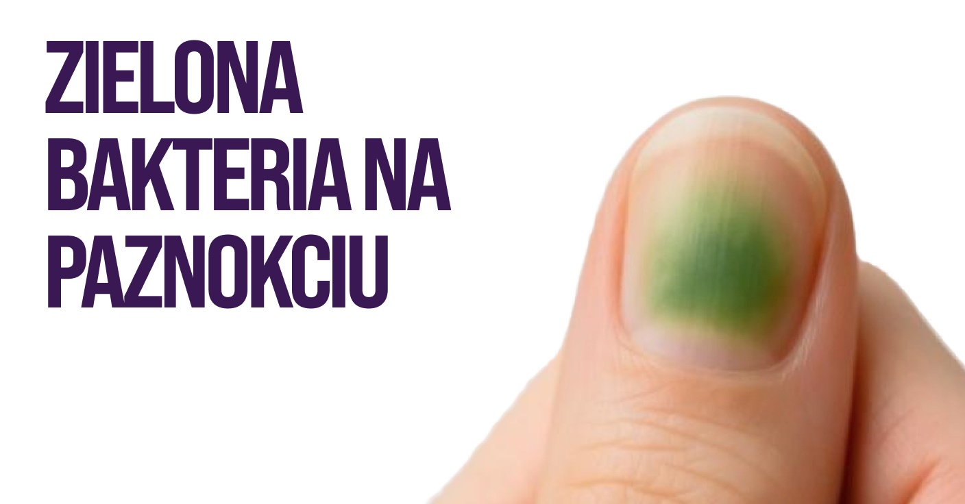 Green bacteria on a nail