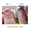 Регенерирующее масло NAILSOFTHEDAY Onistop против онихолизиса 15 мл - Фото №3