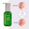 Ремувер для педикюра TUFI profi BioPeeling Fruit Acid для размягчения огрубевшей кожи стоп кислотный 100 мл (0330978) - Фото №3
