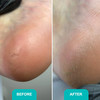 Soft gel for softening calluses and corns Shelly 200 ml - Фото №3
