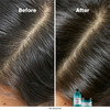 Маска для волос L'Oreal Scalp Advanced 250 мл - Фото №3