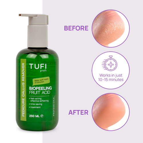 Ремувер для педикюра TUFI profi BioPeeling Fruit Acid для размягчения огрубевшей кожи стоп кислотный 250 мл (0330979) - Фото №2