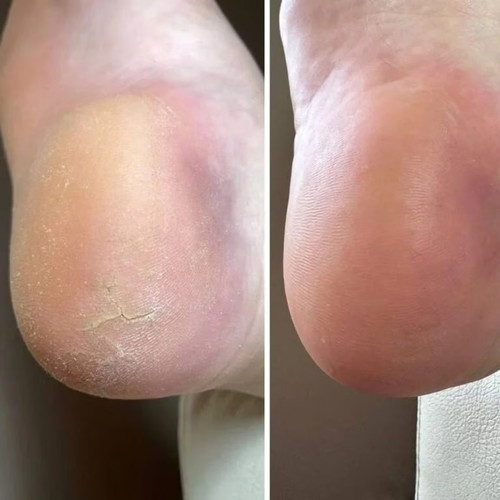 Крем Resultum Anti Crack Cream Jojoba для рук и ног от трещин 25 мл - Фото №5