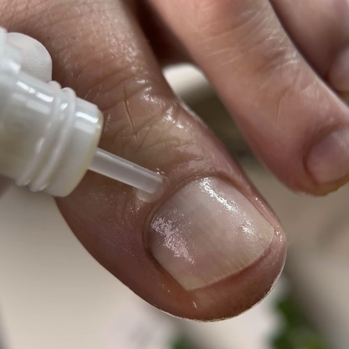 Регенерирующее масло для ногтей при онихолизисе Resultum Onistopix Oil 15 мл - Фото №2