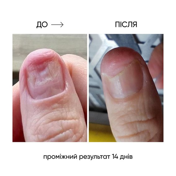 Регенерирующее масло NAILSOFTHEDAY Onistop против онихолизиса 15 мл - Фото №3